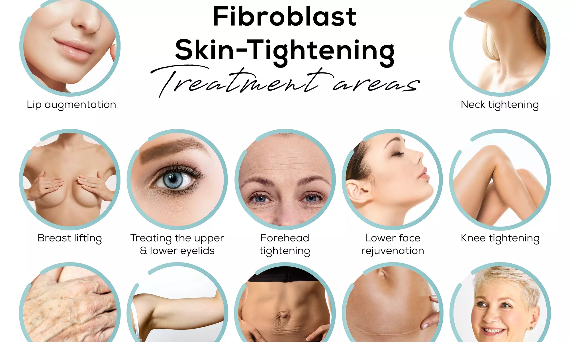 Up to 40% Off on Lipo - Non-Invasive Laser-iLipo at The Plasma Pen Experts - Primary Image