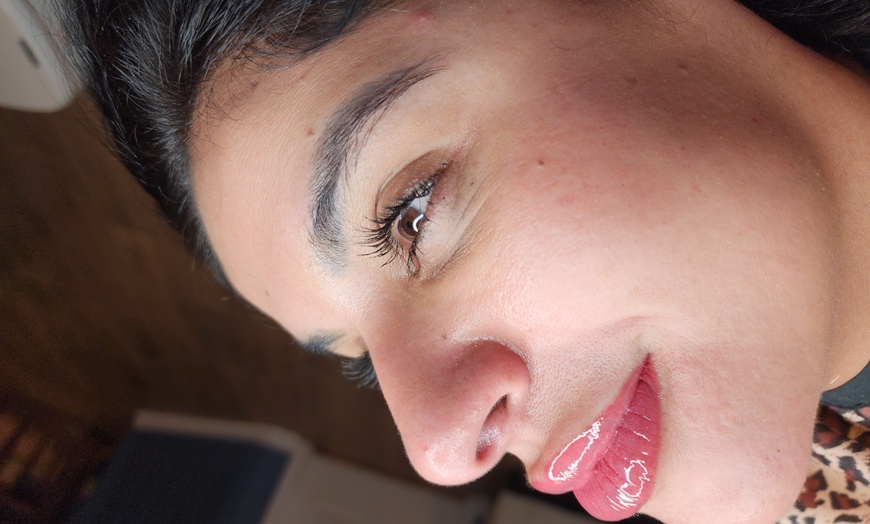 Image 2: Up to 46% Off on Lip Enhancement at Berry Lips by Jussara
