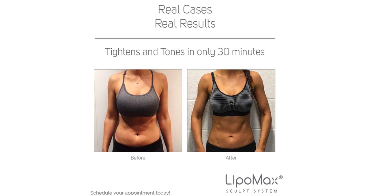 EMS Sculpt for Abs and Core Sessions