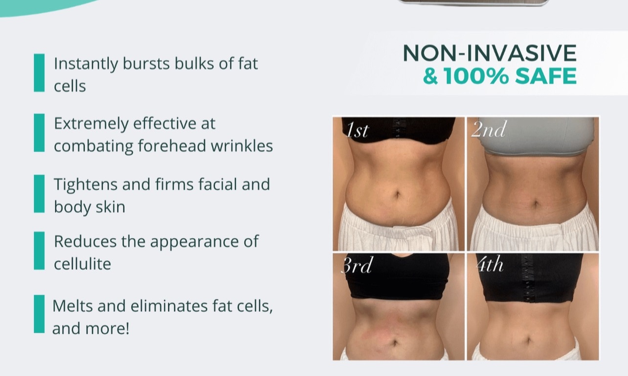 Up to 64% Off on Lipo - Non-Invasive Laser-iLipo at Integrated Restorative Massage Therapy LLC