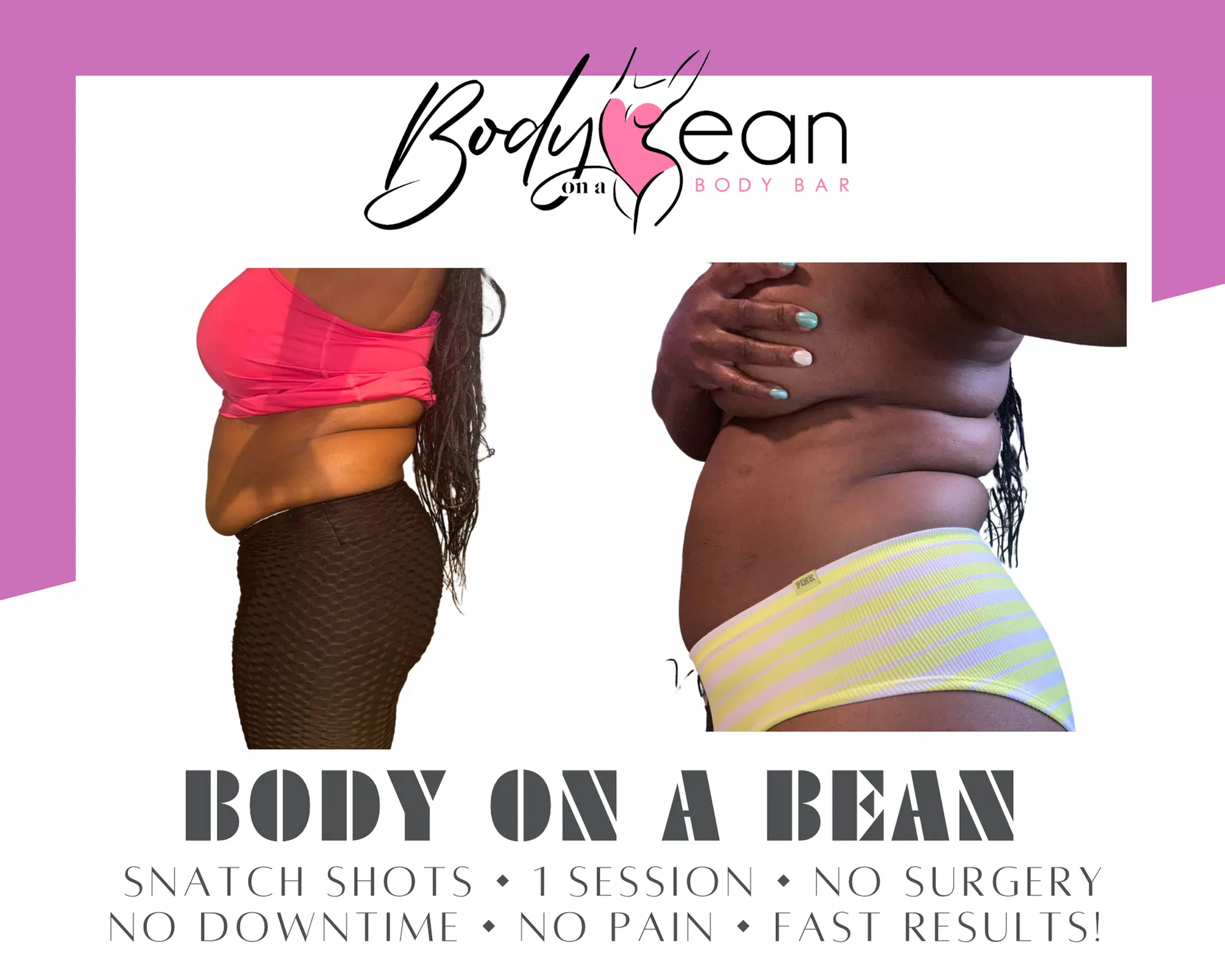 Up to 50% Off on Fat Reduction - Non-Branded at Body on a Bean - Second Medium