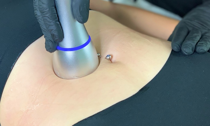 Up to 50% Off on Cryotherapy at Centre For Positive Change