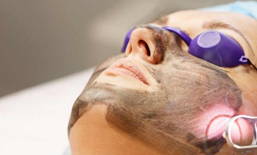 Image 1: Up to 50% Off on Carbon Facial at Cosmoworld