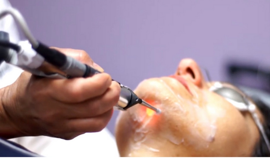Image 2: Up to 40% Off on Laser Hair Removal at Bella Medical Aesthetics