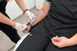 Get rejuvenated at Enigma Medi Spa & Laser Center with a PRP Facial including RF Microneedling, offering up to 65% off - Second Medium