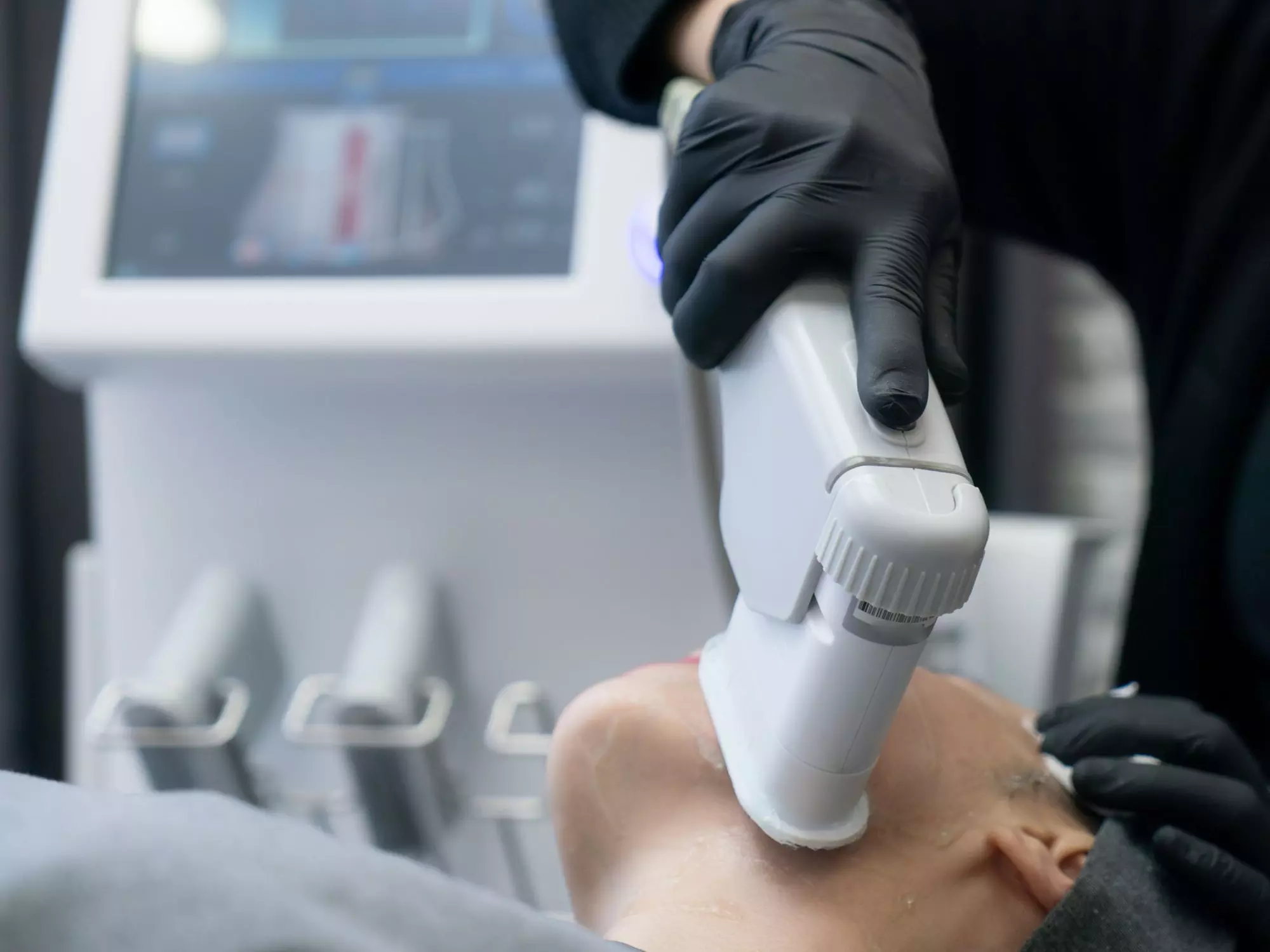 Up to 52% Off on HIFU at London Body Centre