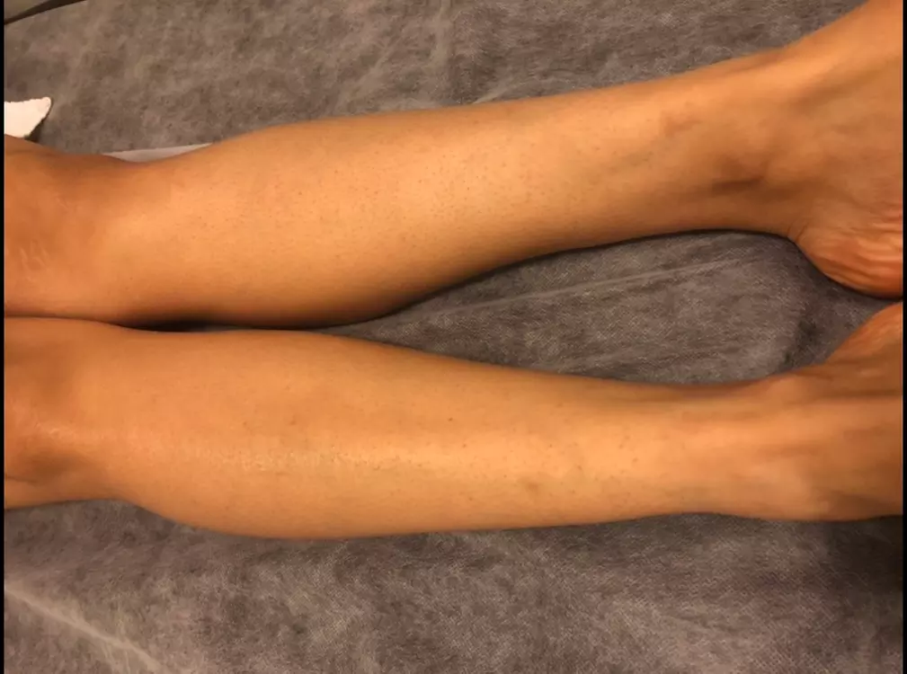 Up to 10% Off on Waxing at WAX IT OFF - Second Medium
