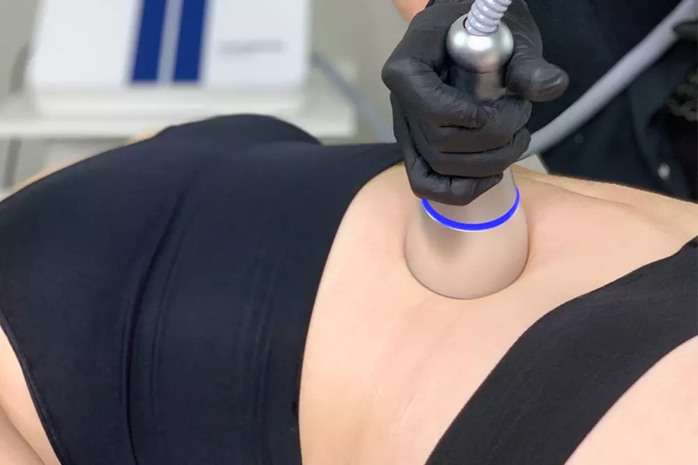 Up to 40% Off on Ultrasonic Fat Reduction at Club Recharge