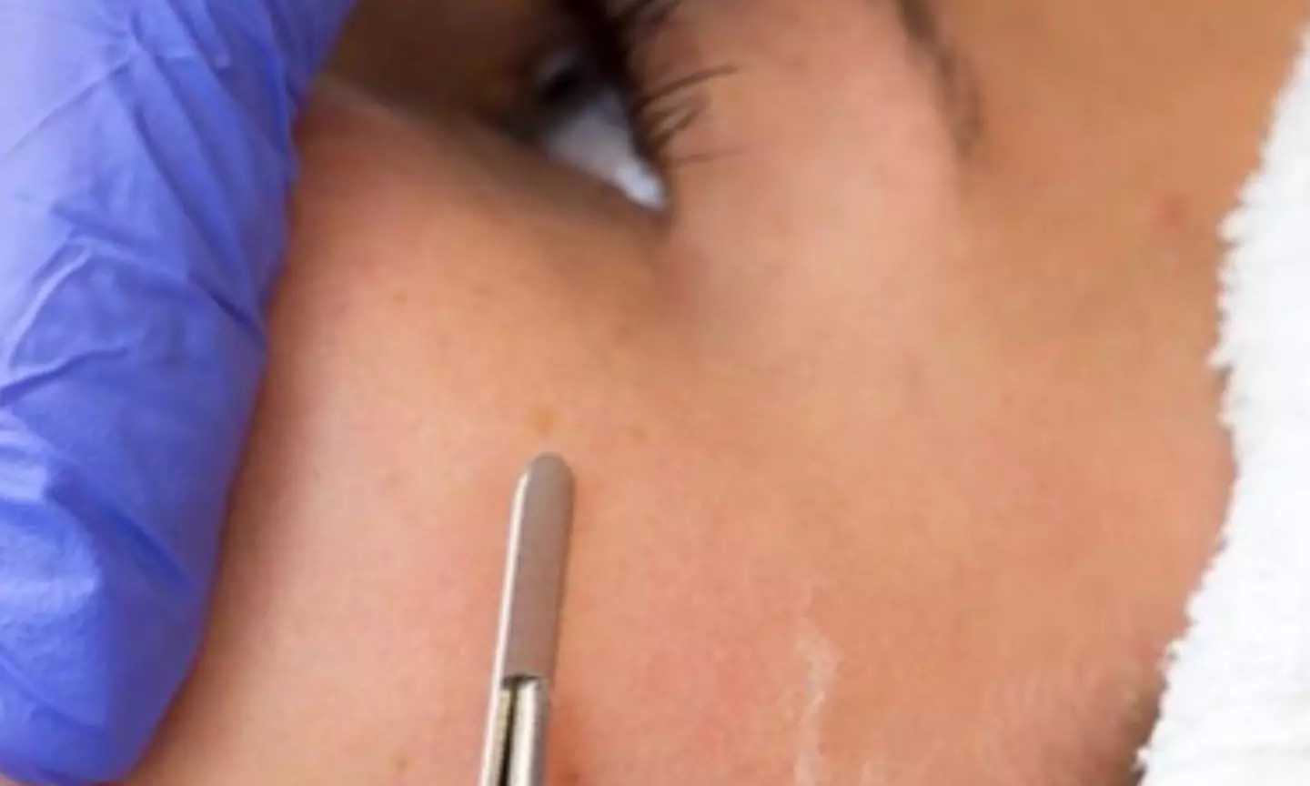 Experience Citrus & Vine Corrective Skincare LLC's Exclusive Luxury Facial and Dermaplane with Hydrojelly Mask for up to 55% off - Image 3