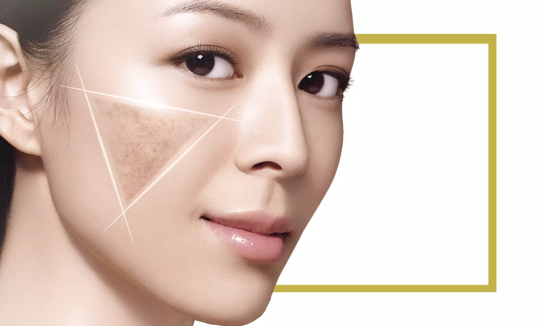 Experience DLing Medical Aesthetic Center's Hollywood Peel Laser Session with up to 48% off for smoother skin - Primary Image