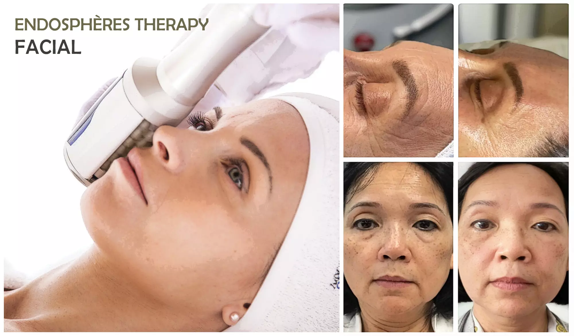 Up to 37% Off on Lymphatic Drainage Treatment at Dream Body Medspa - Second Medium