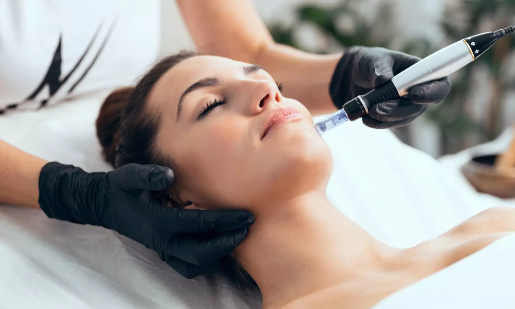 Smooth Skin Transformation with Various Microneedling Sessions