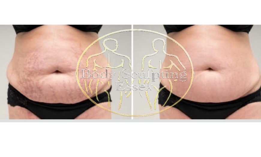 Image 5: Tone and Relax with Electromagnetic Sculpting w/ Private Sauna & More!