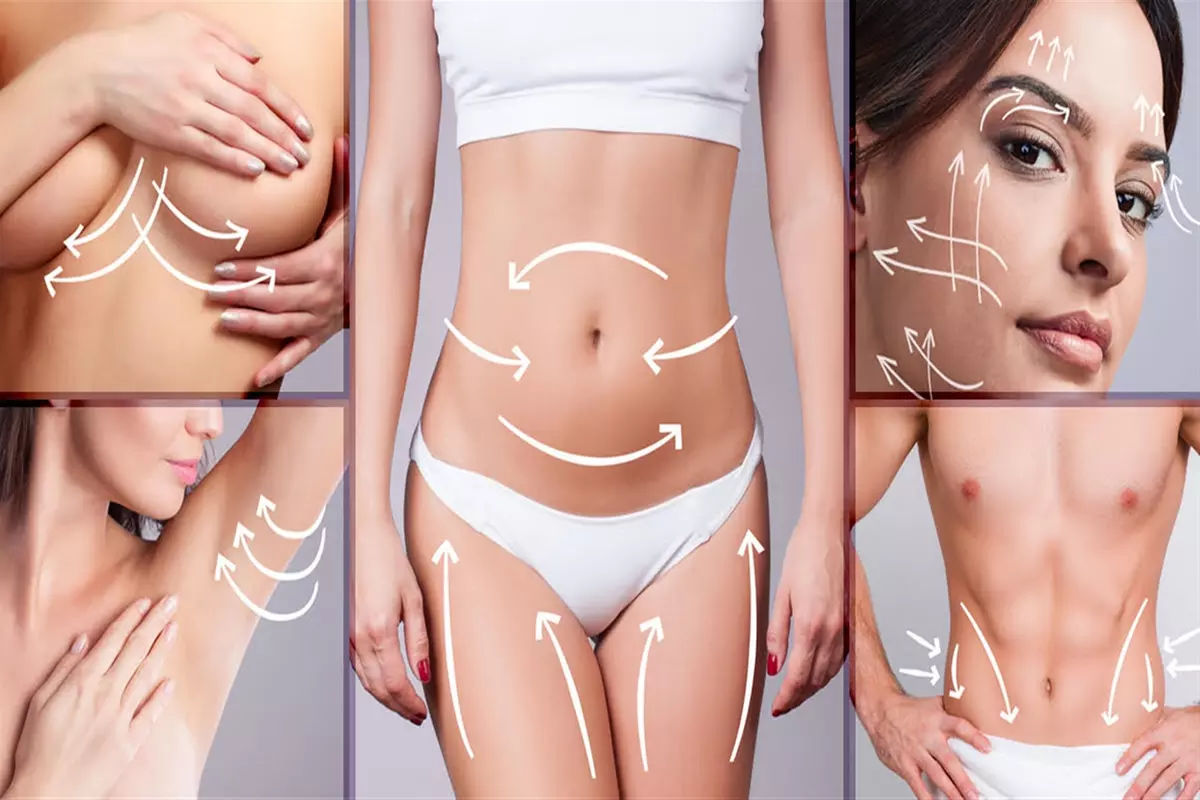 Up to 70% Off on Fat / Cellulite Reduction - Non-Branded at UK Aesthetics Lounge