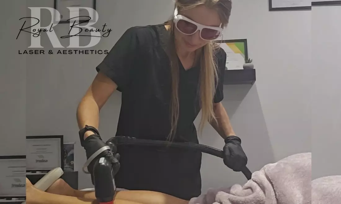 Up to 75% Off on Laser Hair Removal at Royal Beauty Laser & Aesthetics - Second Medium