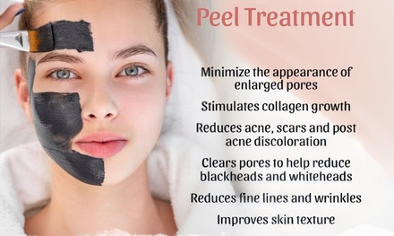 Carbon laser peel