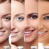 Image 3: Up to 60% Off on Micro-Needling at Brazilian beauty advanced aesthetic