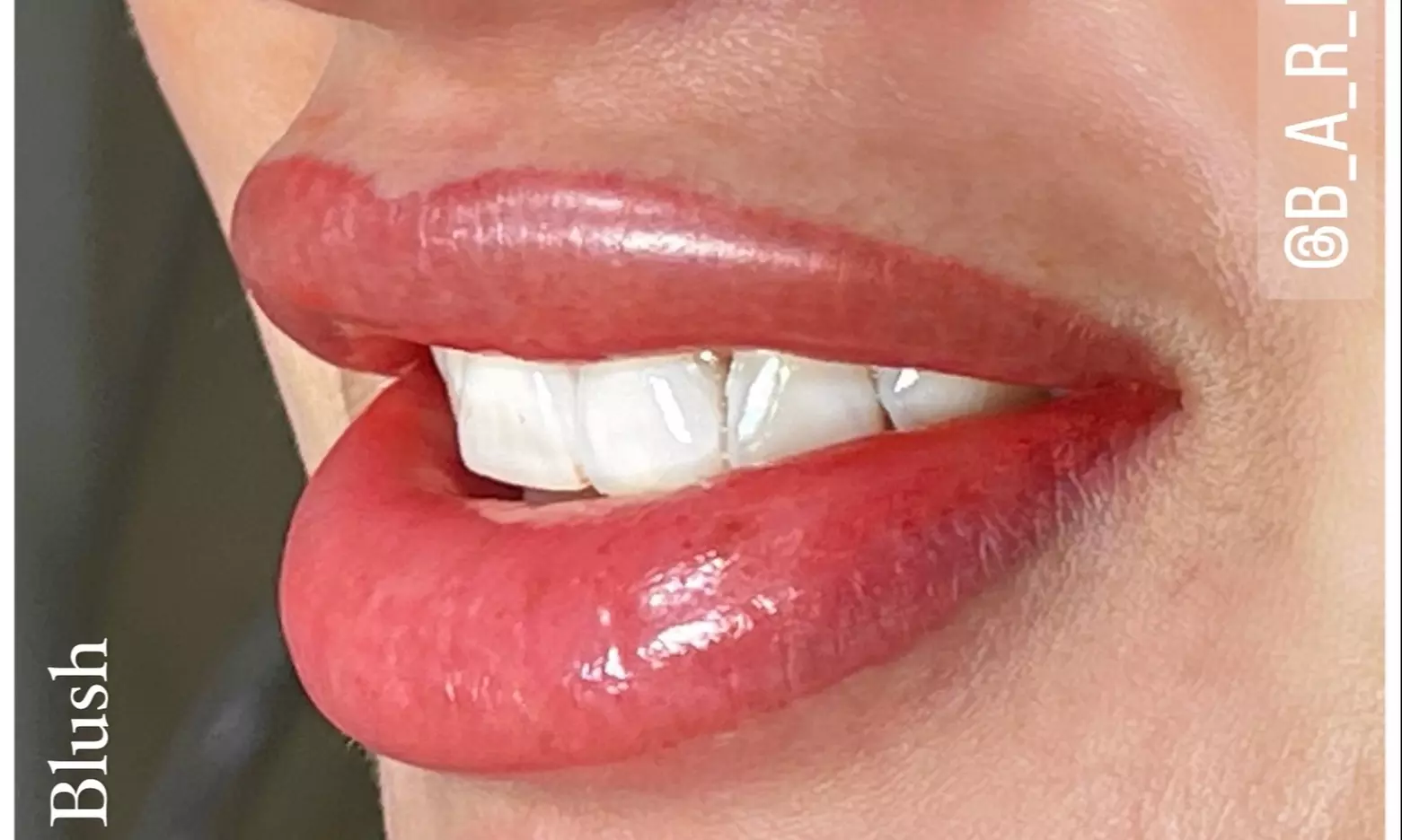 Experience B.A.R. NYC's lip enhancement with options like permanent blush for vibrant lips up to 30% off - Primary Image