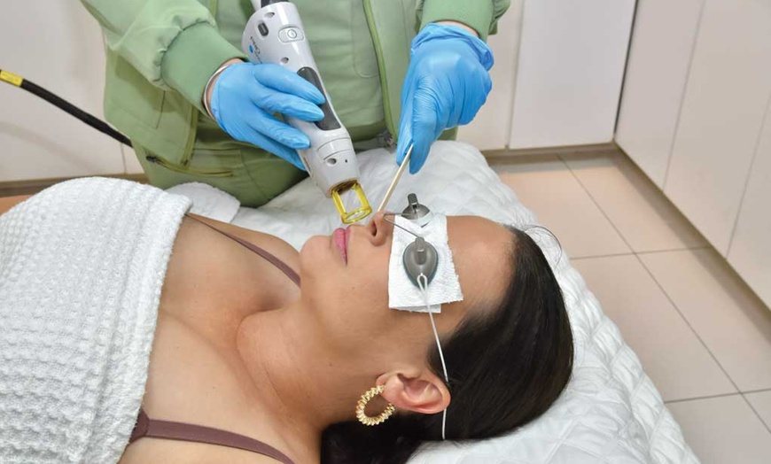 Image 5: Pack of Four Laser Hair Removal Sessions on Different Areas