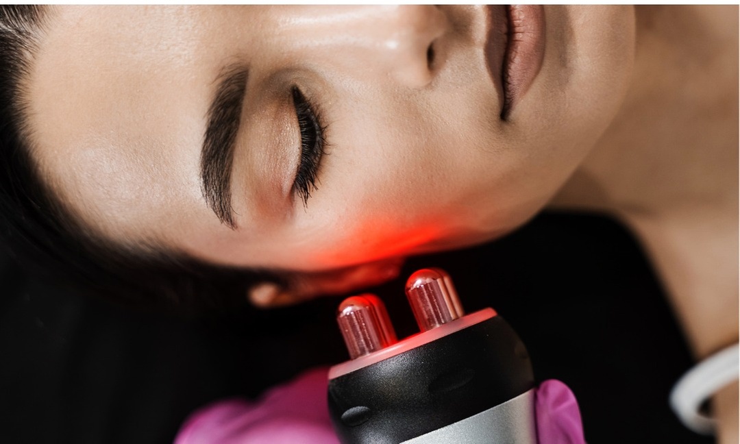 Quick RF Skin Tightening Facial Sessions for Youthful Glow