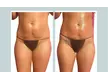 Up to 60% Off on Fat Reduction - Non-Branded at Beauty By Drea Renae - Second Medium