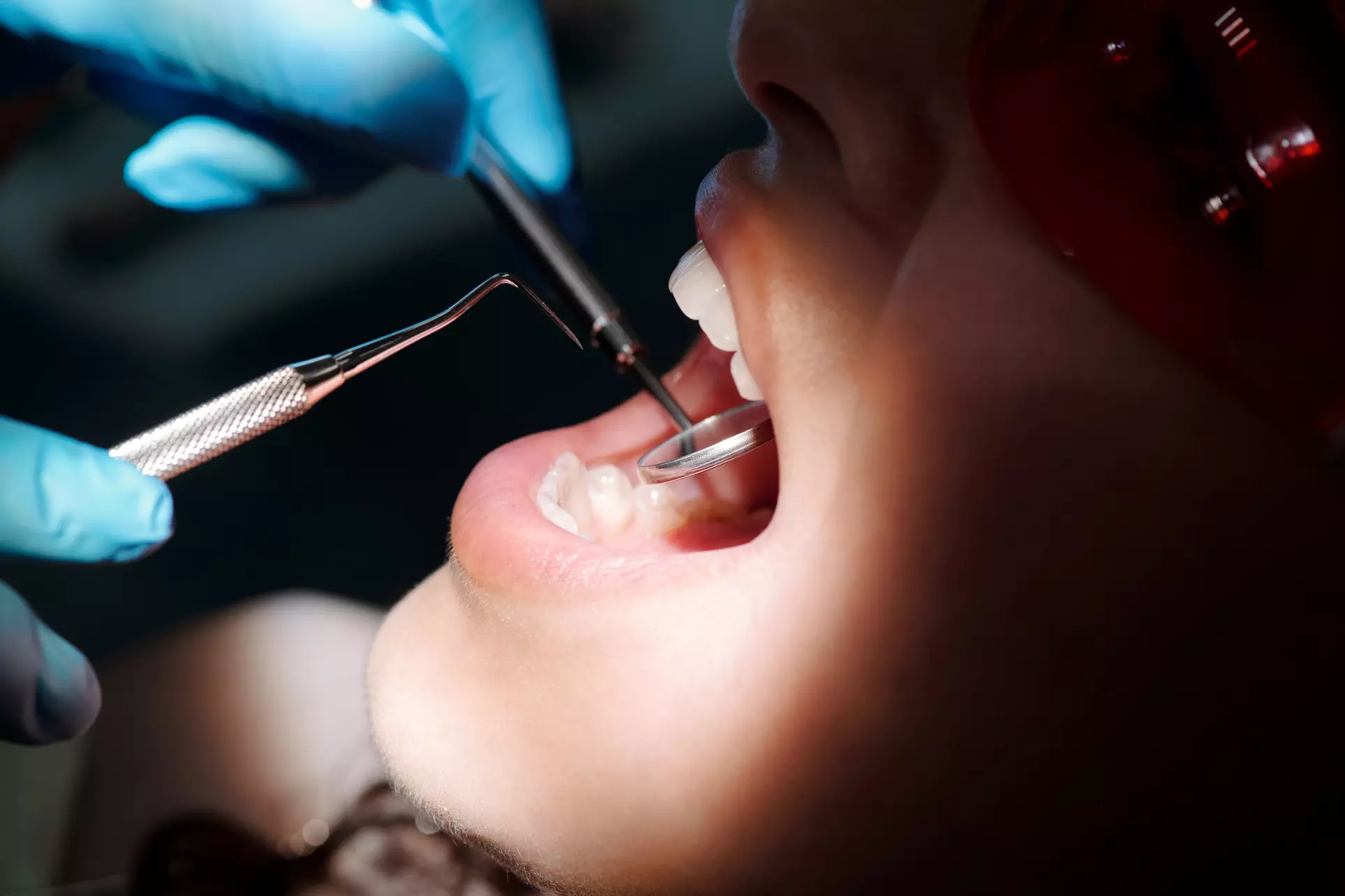 Up to 59% Off on Dental Implant / Corona / Veneer at The Glowing Smile - Second Medium