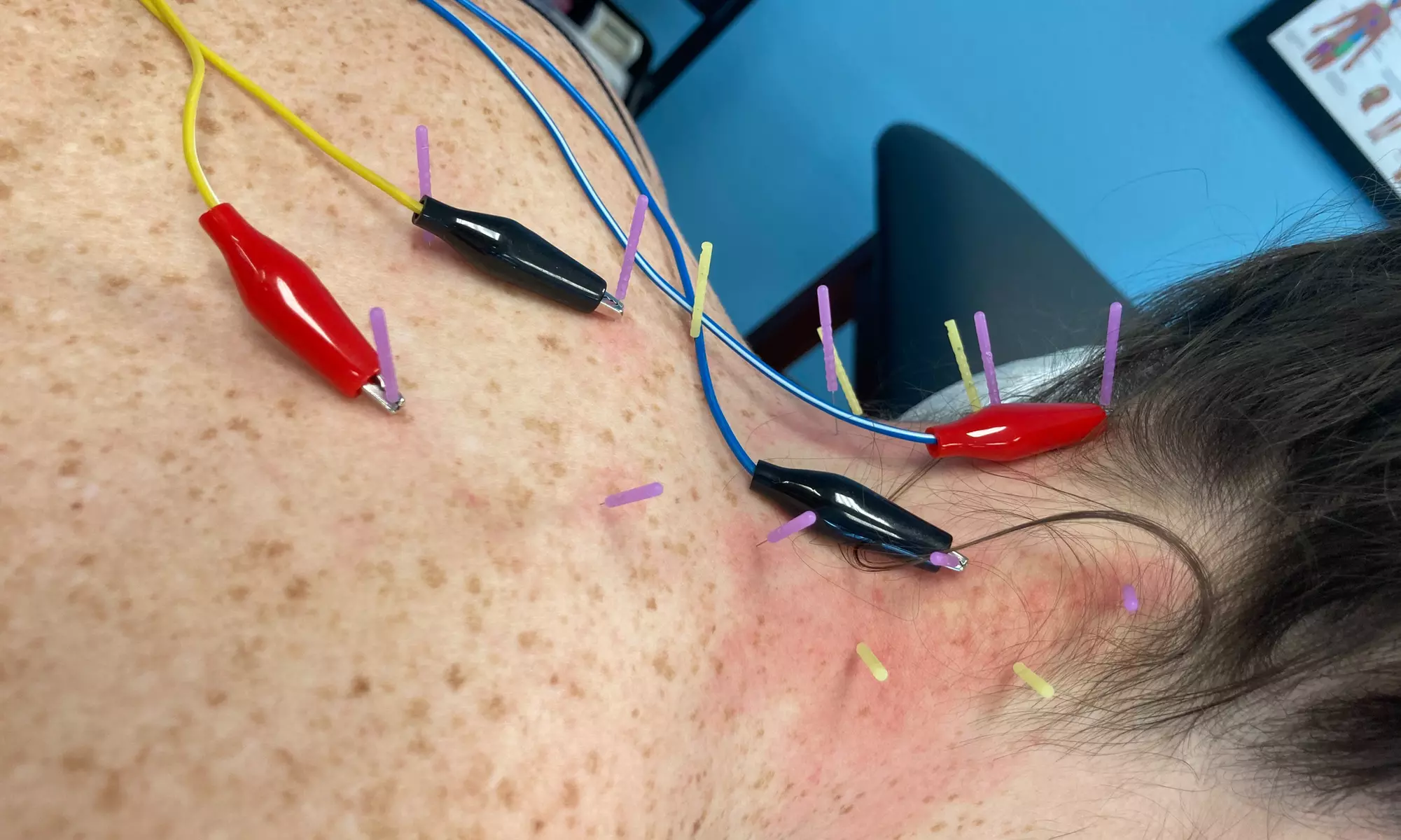 Consultation, Examination & a Adjustment with Expert-Led Sessions