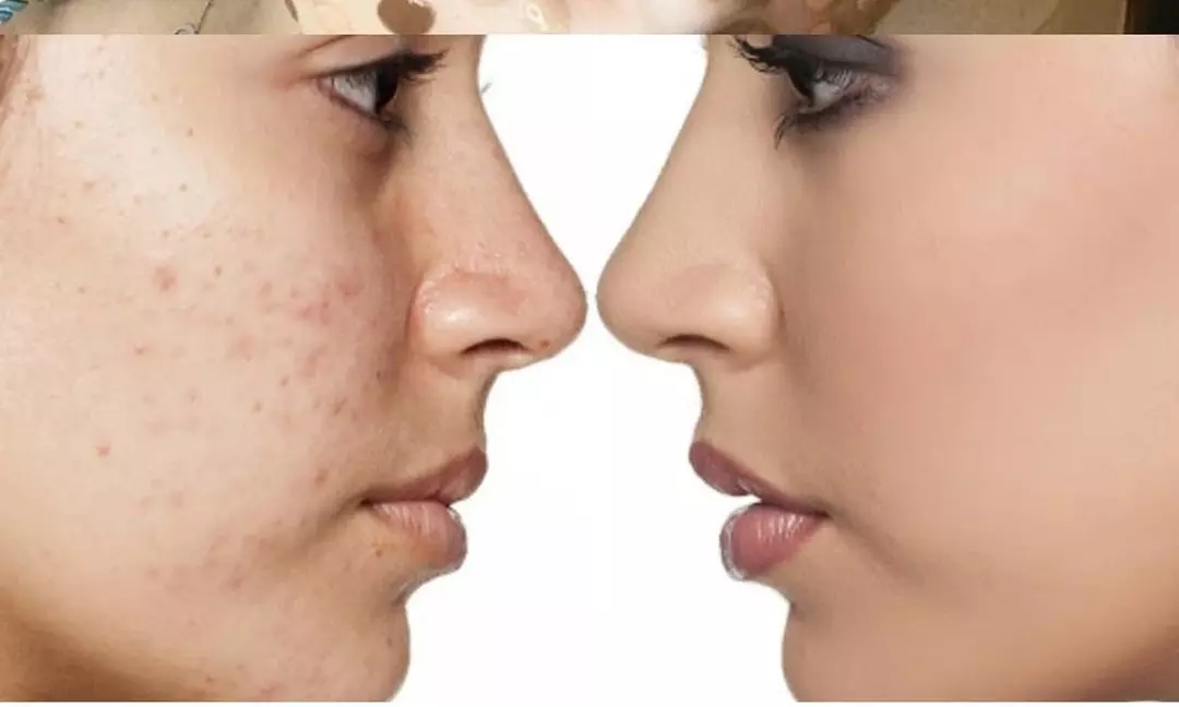Indulge in rejuvenating facials with Derma Glow offering options for one or two sessions up to 45% off - Primary Image