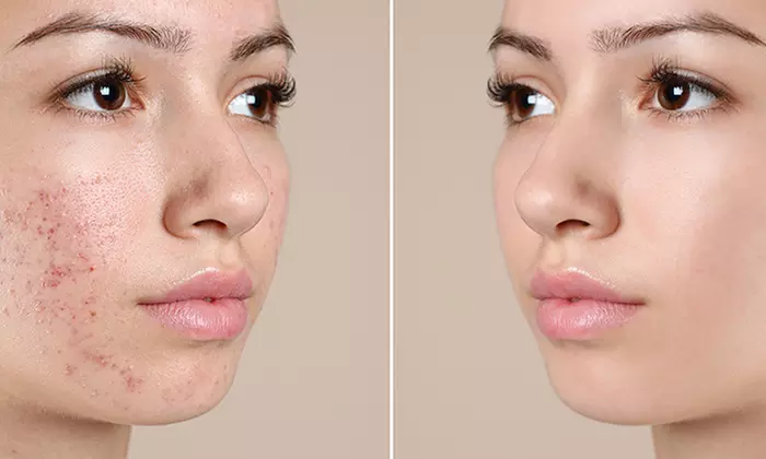 Transform Skin with Naturale Touch SpaTique's Exclusive Treatments