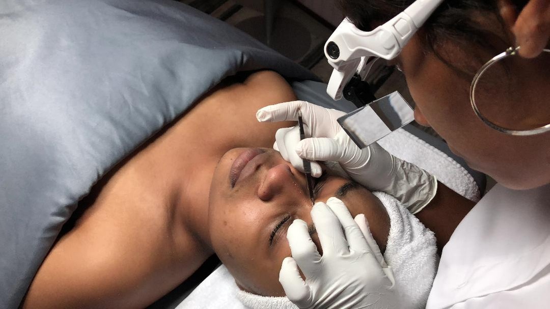 Diamond Peeling Facial and Brazilian Wax Treatment