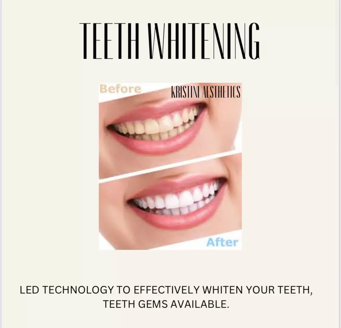Transform your smile at Aesthetics By Kristini with options for teeth whitening treatments up to 60% off - Primary Image