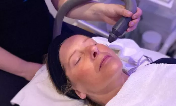 Up to 60% Off on Cryotherapy at UK Aesthetics Lounge