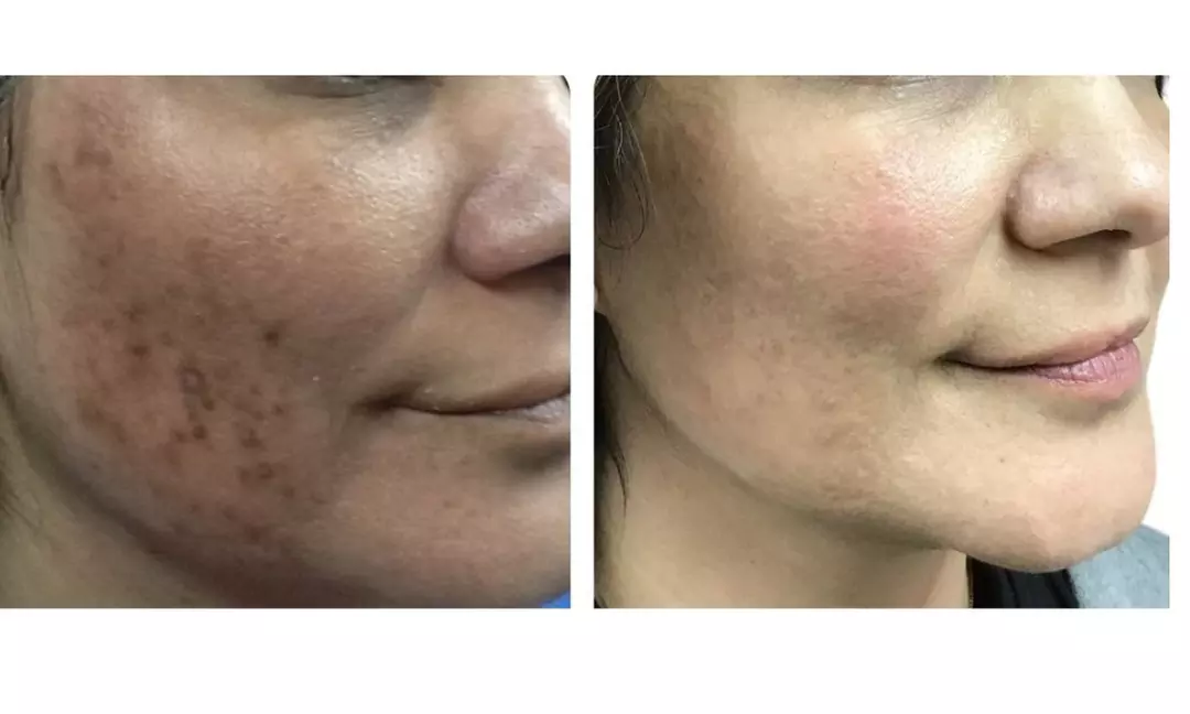 Experience rejuvenating skin treatments with Rafael Diaz-Yoserev, MD., FACS offering options for face, neck, or hands up to 30% off - Primary Image