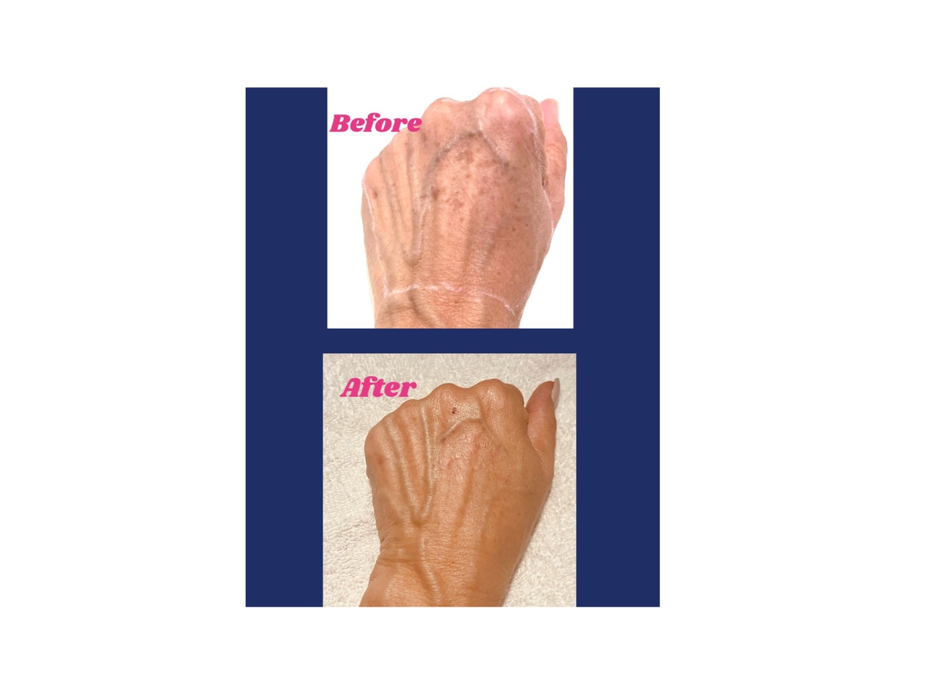 Up to 46% Off on Injection - Plasma