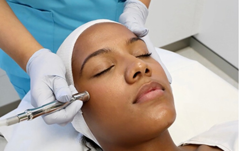 Image 2: Up to 35% Off on Microdermabrasion at Sweet Rituals Skin Spa
