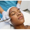 Image 2: Up to 35% Off on Microdermabrasion at Sweet Rituals Skin Spa