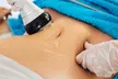Up to 58% Off on Radio Frequency Skin Tightening at UK Aesthetics Lounge - Second Medium