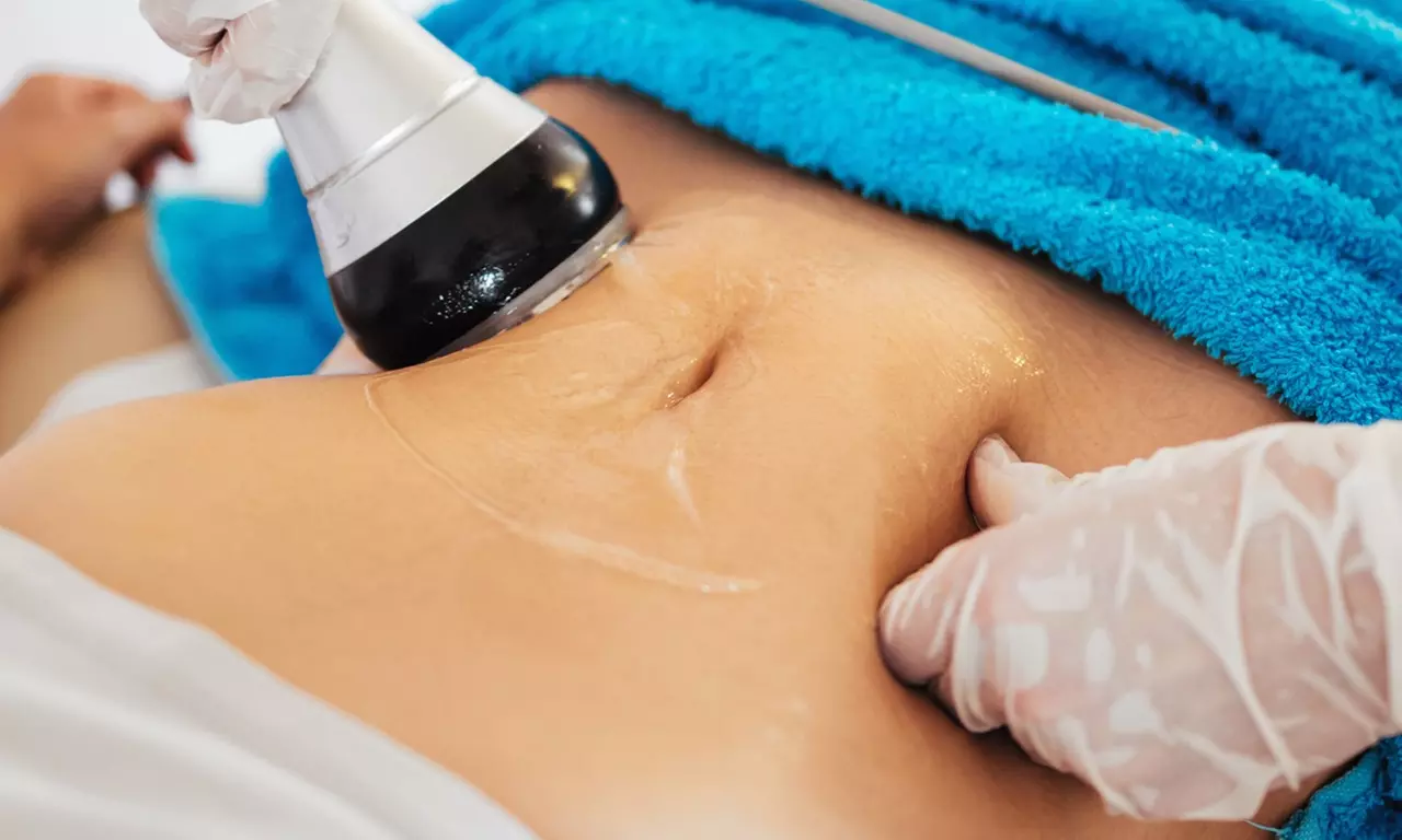 Up to 65% Off on Radio Frequency Skin Tightening at UK Aesthetics Lounge