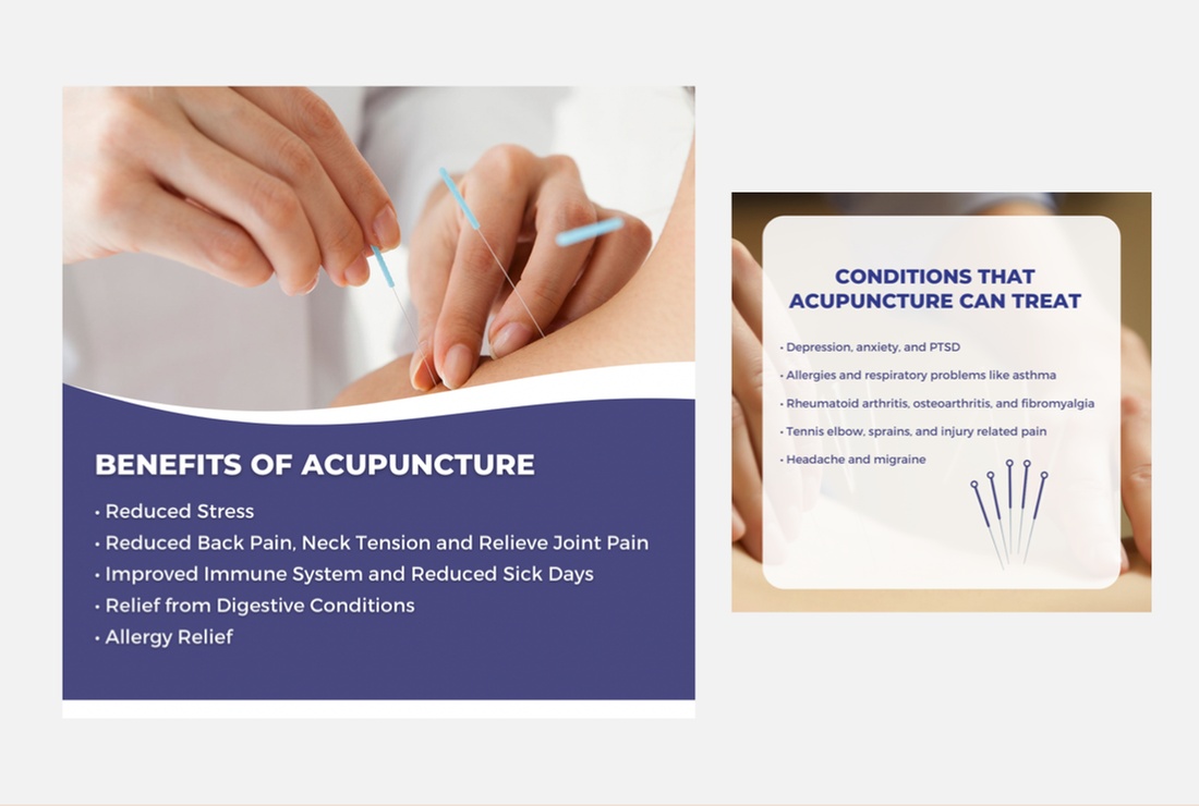 Up to 59% Off on Acupuncture at SDR Healing Acupuncture