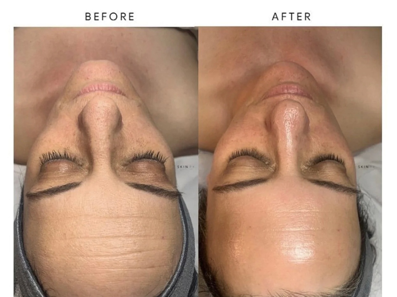 Up to 55% Off on HydraFacial at Fit + Fuel