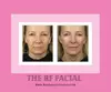 Up to 55% Off on Radio Frequency Anti-Aging Facials at Bea Beauty by Lillie