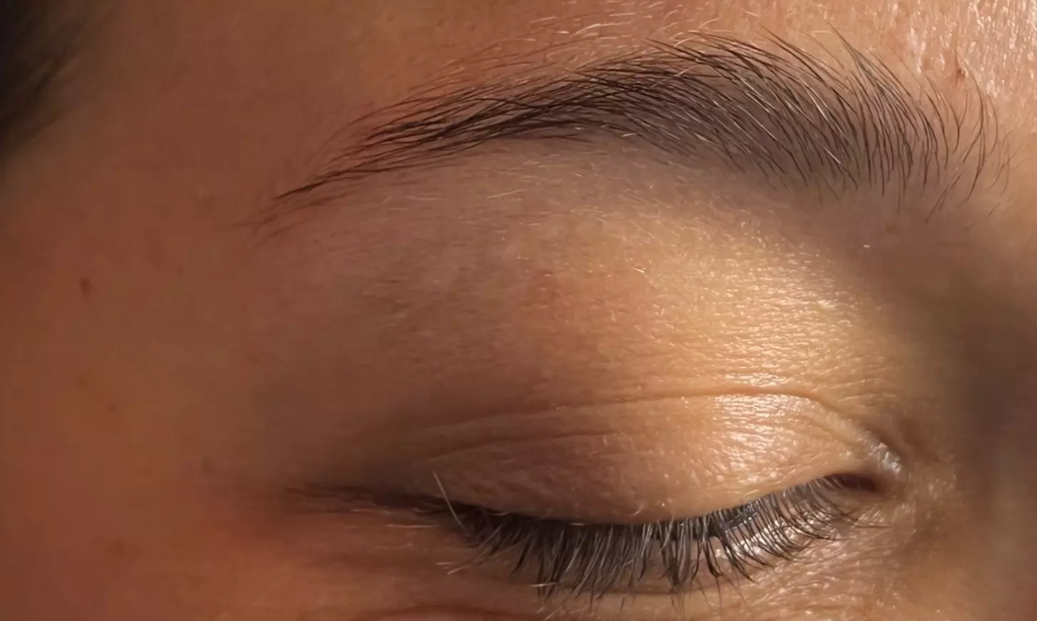 52% off Eyebrow tattoo removal at The Mbar Medspa