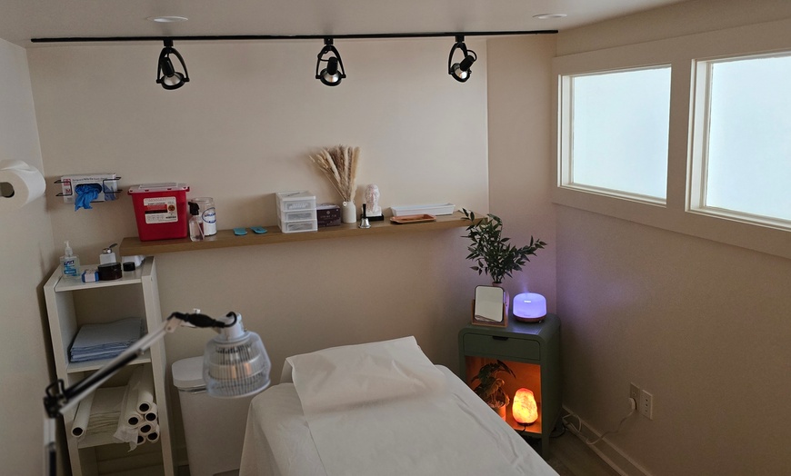 Image 6: Experience Acupuncture with a Single Session