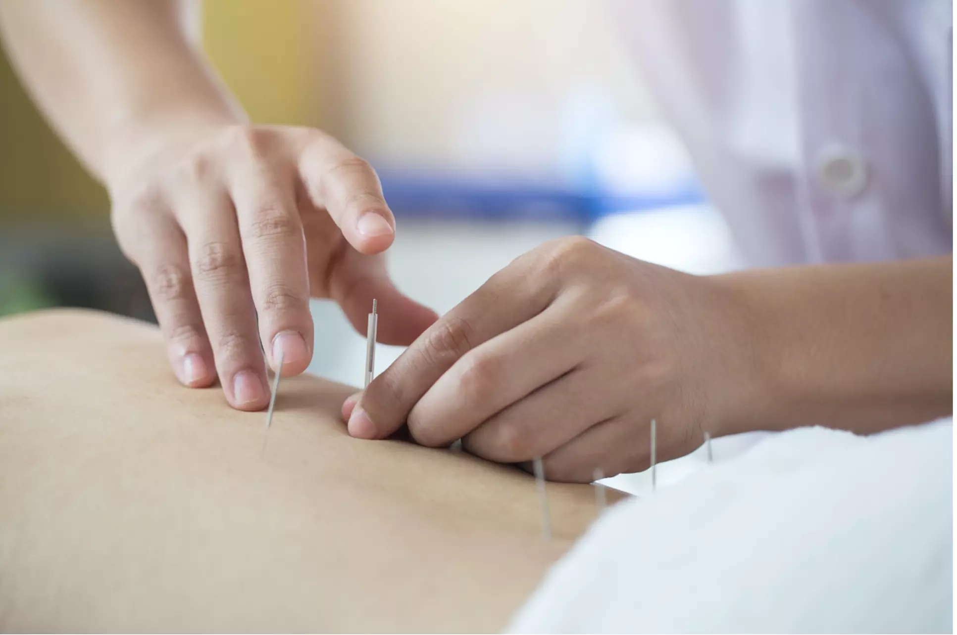 Experience infrared therapy with cupping for relaxation (Up to 69% Off) - Primary Image