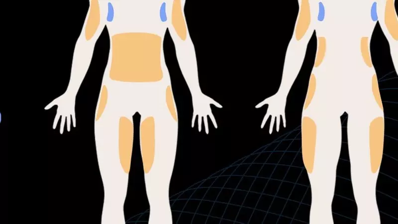 Up to 56% Off on Ultrasonic Fat Reduction at FTS Body Sculpting - Primary Image