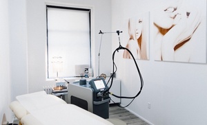 Laser Spider Vein Removal