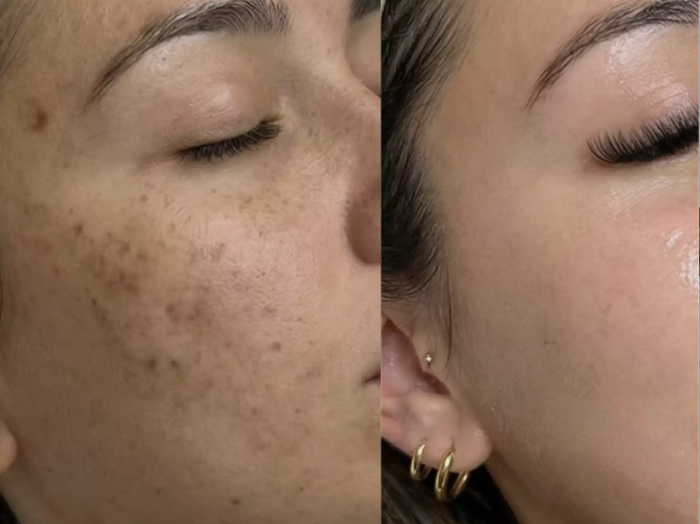 Unifiez votre teint avec un soin anti-taches ciblé 5G Removal