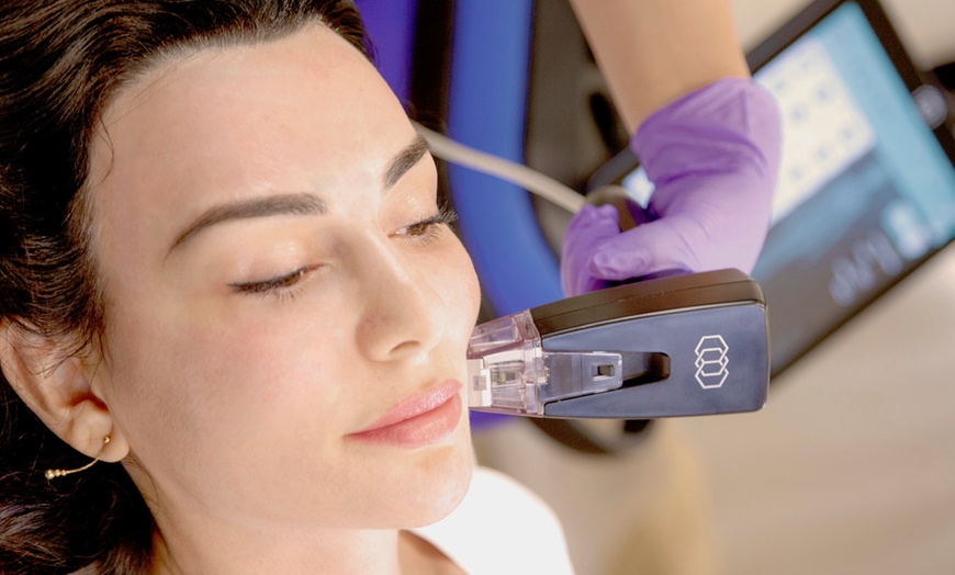 Image 2: Smooth Out Fine Lines with Botox or Juvéderm (Up to 62% Off)