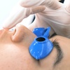 Image 2: One 60 or 75 -Minute Microdermabrasion Treatment
