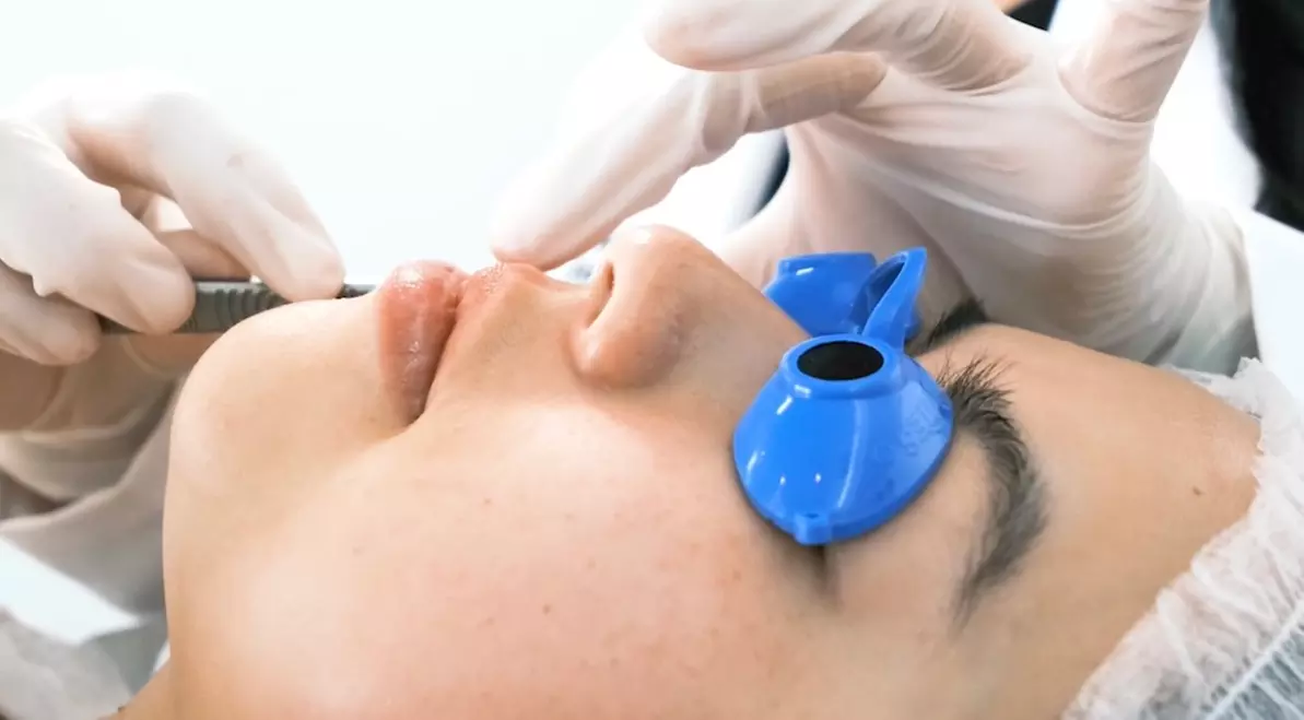 Get One 60 or 75 -Minute Microdermabrasion Treatment - Up to 55% Off at La Jolla Skin Studio - Image 2